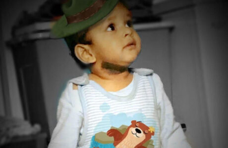 my-son-with-noticeable-birthmark-on-his-neck